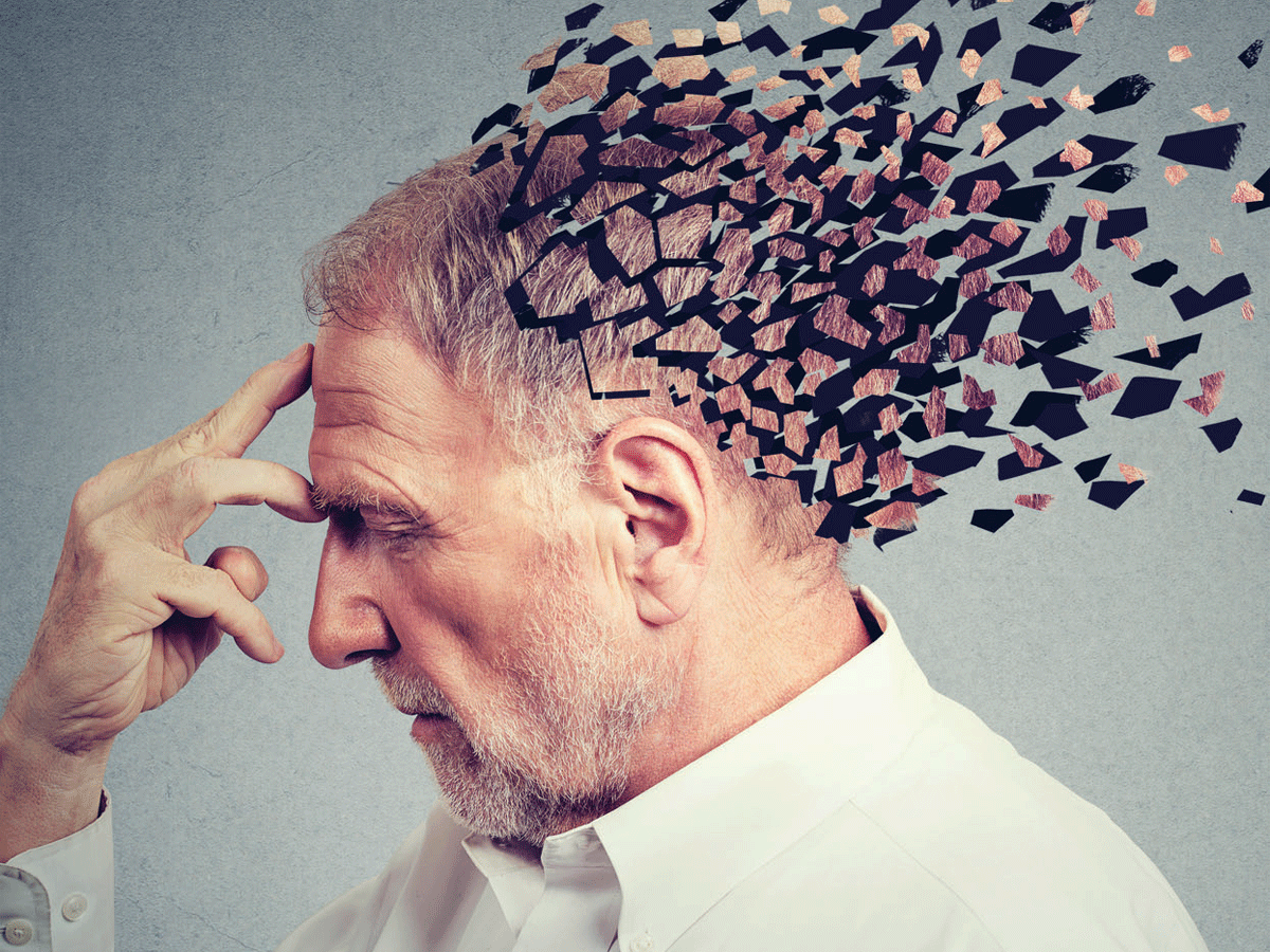 Amnesia Sementara (Transient Global Amnesia)